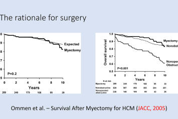 Septal myectomy or Alcohol septal ablation?